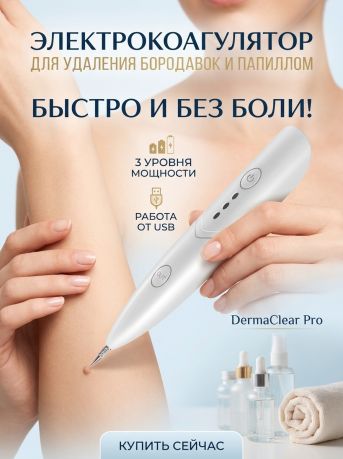 Плазменная ручка YP03 для удаления папиллом, бородавок.