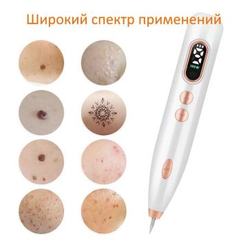 Косметологический аппарат OLLO Store Плазменная ручка (Mole Freckle Removal Pen) для удаления бородавок и папиллом с электронным дисплеем и с аккумулятором