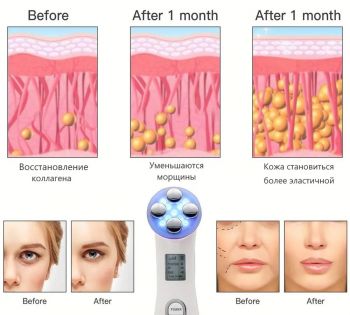 Аппарат для мезотерапии MEZO и электропорации лица, подтяжка лица, удаление морщин