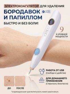 Плазменная ручка для удаления бородавок и папиллом с ЖК - дисплеем и 9 режимами.